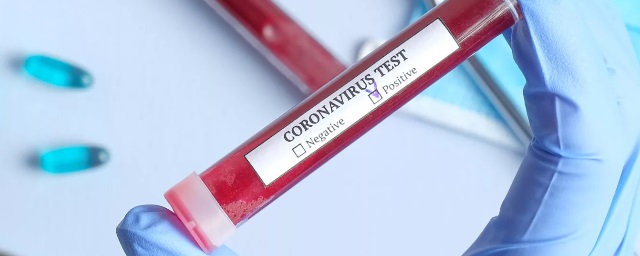В Саранске коронавирусом заболели еще 69 человек